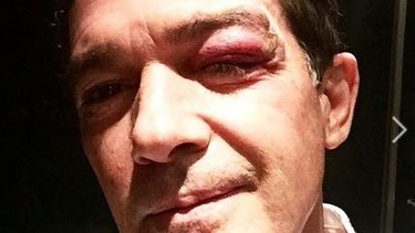 Rodar es emocionante y a veces peligroso y para muestra mi ojo!, escribía en Twitter el actor español&nbsp;