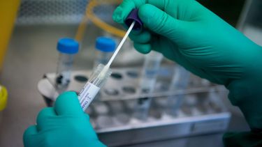 Cientos de laboratorios realizan pruebas de COVID-19 en Florida.