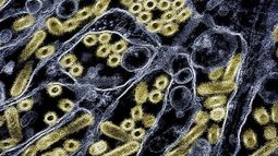 Micrografía del virus de influenza aviar altamente patógena.