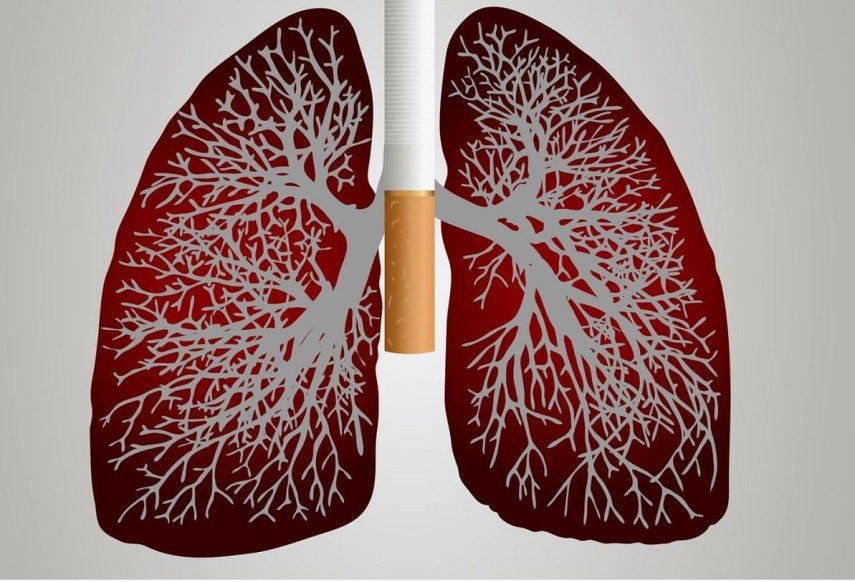 Investigadores del Centro de Investigación de Cáncer (CIC, CSIC-USAL-FICUS) y del Instituto de Biomedicina de Sevilla (IBiS, US-CSIC-Junta de Andalucía) han identificado la proteína SOS1, un activador universal de proteínas RAS en células de mamíferos, como una nueva diana terapéutica en adenocarcinoma de pulmón -el tumor más frecuente en este órgano-, y en otros cánceres dependientes de oncogenes RAS mutados.