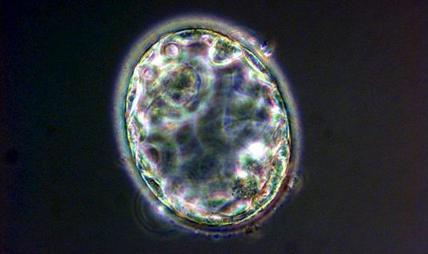 Blastocito de cinco días de un embrión&nbsp;humano&nbsp;clonado