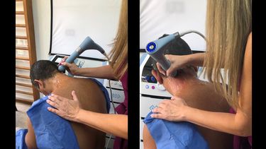 Paciente experimenta nueva terapia para mejorar los síntomas del Parkinson.