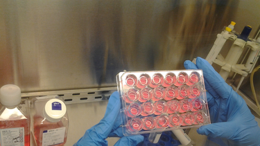 Ejemplo de un cultivo de piel e