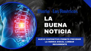 nuevo dispositivo permite prevenir la hernia discal lumbar recurrente