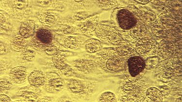 Esta imagen de microscopio de 1975 provista por los Centros para el Control y Prevenci&oacute;n de Enfermedades de Estados Unidos muestra una bacteria de chlamydia trachomatis magnificada 200 veces.&nbsp;