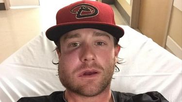 El pitcher fue golpeado en su rostro por un batazo disparado por el venezolano Carlos González