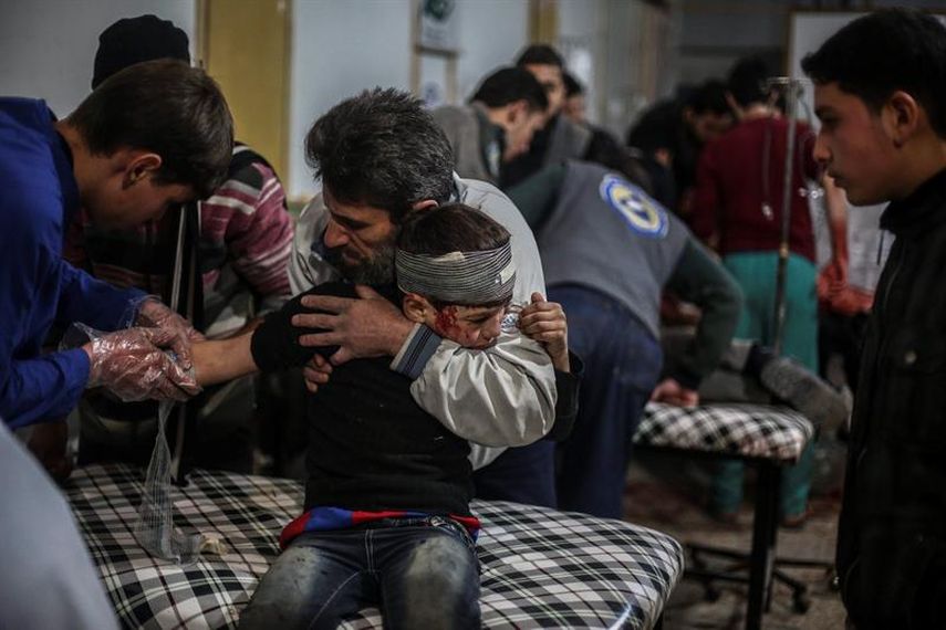 Un niño recibe tratamiento en un hospital tras los bombardeos por las fuerzas afines al gobierno sirio en Douma, a las afueras de Damasco, Siria. (EFE)