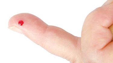 La nueva tecnología permite analizar de forma exhaustiva los anticuerpos virales presentes en la sangre de una persona, para así descubrir a qué virus ha estado expuesta a lo largo de su vida.(CORTESÍA)