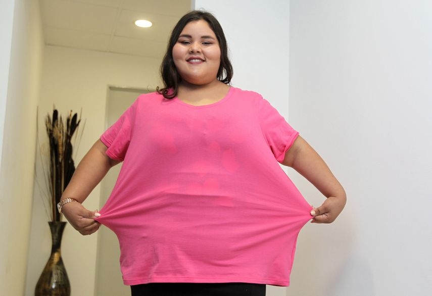 Dayana Camacho, quien fue considerada la adolescente más obesa del mundo.