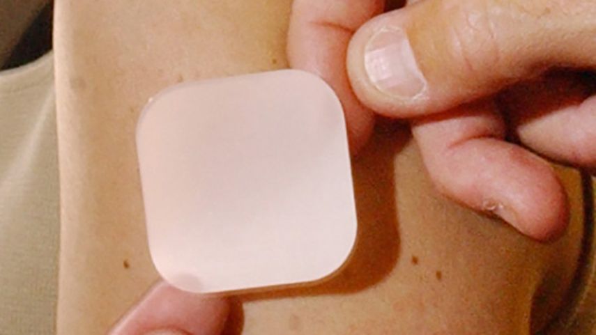 Este dispositivo subcutáneo del tamaño de una pequeña moneda está recubierto de un centenar de micro-agujas similares a una pestaña. (CORTESÍA)