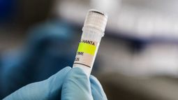 Argentina ha registrado un aumento en los casos de hantavirus, pero no un brote, según declaró un experto a la AFP el 6 de mayo, mientras que las infecciones a bordo de un crucero han provocado una alarma sanitaria mundial. El MV Hondius zarpó de Ushuaia, en el sur de Argentina, el 1 de abril y actualmente se encuentra anclado frente a las costas de Cabo Verde tras la muerte de tres pasajeros, posiblemente a causa del hantavirus. Argentina ha registrado un aumento en los casos de hantavirus, pero no un brote, según declaró un experto a la AFP el 6 de mayo, mientras que las infecciones a bordo de un crucero han provocado una alarma sanitaria mundial. El MV Hondius zarpó de Ushuaia, en el sur de Argentina, el 1 de abril y actualmente se encuentra anclado frente a las costas de Cabo Verde tras la muerte de tres pasajeros, posiblemente a causa del hantavirus.