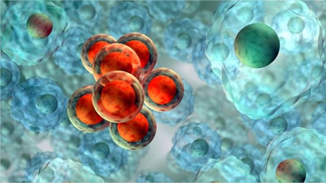 Avanzan las investigaciones contra el cáncer de vejiga Avanzan las investigaciones contra el cáncer de vejiga