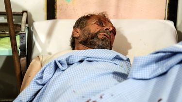 Un hombre víctima de una bomba recibe atención médica en Douma (Siria) hoy, según fuentes, las fuerzas leales al régimen de Al Assad lanzaron bombas aéreas a Douma y otras ciudades de la localidad de Ghouta. No hay cifra oficial de heridos o fallecidos