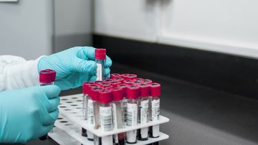 Los ex&aacute;menes m&eacute;dicos se realizan en laboratorios especializados.