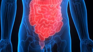 Cáncer de colon, la prevención es indispensable&nbsp;