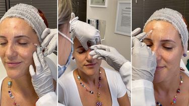 El bótox es considerado uno de los medicamentos más exitosos de rejuvenecimiento.