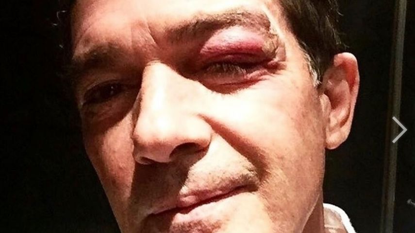 Rodar es emocionante y a veces peligroso y para muestra mi ojo!, escribía en Twitter el actor español&nbsp;