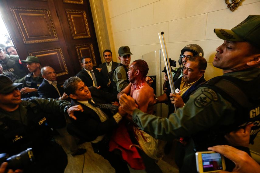 Varios trabajadores y periodistas fueron agredidos mientras que los  diputados opositores Américo de Grazia, Armando Armas, Luis Padilla y  Leonardo Regnault sufrieron heridas de consideración