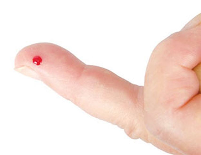 La nueva tecnología permite analizar de forma exhaustiva los anticuerpos virales presentes en la sangre de una persona, para así descubrir a qué virus ha estado expuesta a lo largo de su vida.(CORTESÍA)