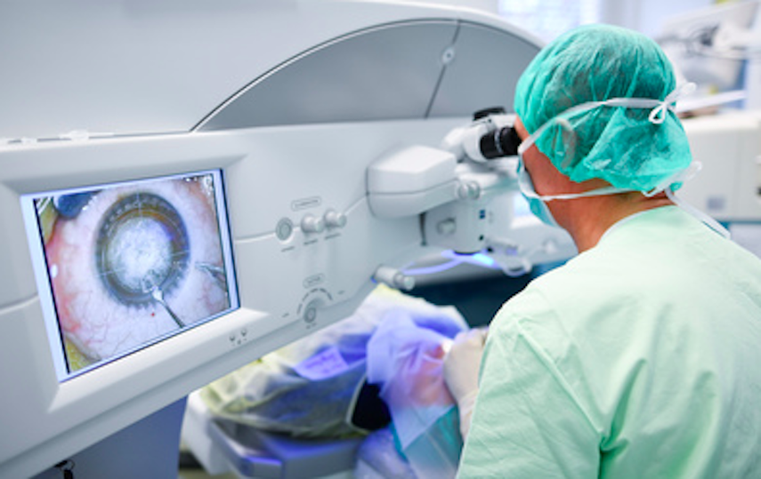 Durante la operación se ve el ojo del paciente agrandado gracias a un microscopio.