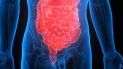 Un estudio confirma que los antibióticos aumentan el riesgo de cáncer de colon Un estudio confirma que los antibióticos aumentan el riesgo de cáncer de colon