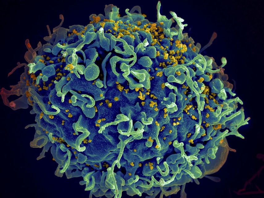 Esta imagen captada con un microscopio electrónico y facilitada por los Institutos Nacionales de Salud de Estados Unidos muestra una célula T, en azul, siendo atacada por el VIH, el virus que causa el sida, en amarillo.&nbsp;