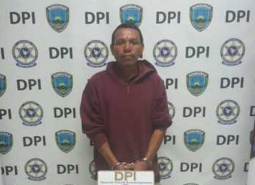 Elvin Omar Sánchez González, de 37 años, fue detenido por supuestamente arrancarle la nariz a mordidas a un vecino en Comayagua, Honduras.