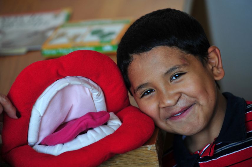 Cada tres minutos nace en el mundo un niño víctima de estas malformaciones congénitas que distorsionan su rostro, aunque se trata de un problema con solución