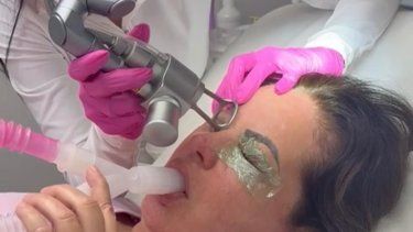 Fabiola Lucena realiza un tratamiento con láser CO2 en el área de los ojos.&nbsp;