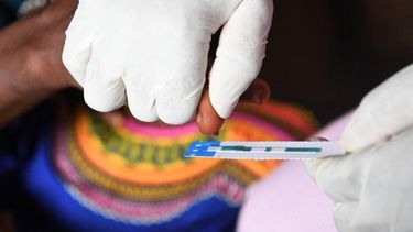 12 millones de pacientes de VIH no reciben tratamiento según OMS