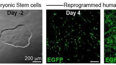 Este método reprograma células madre embrionarias en neuronas, ofreciendo una herramienta para investigar fundamentos genéticos y moleculares de los trastornos del desarrollo neurológico inducidos por fármacos.&nbsp;