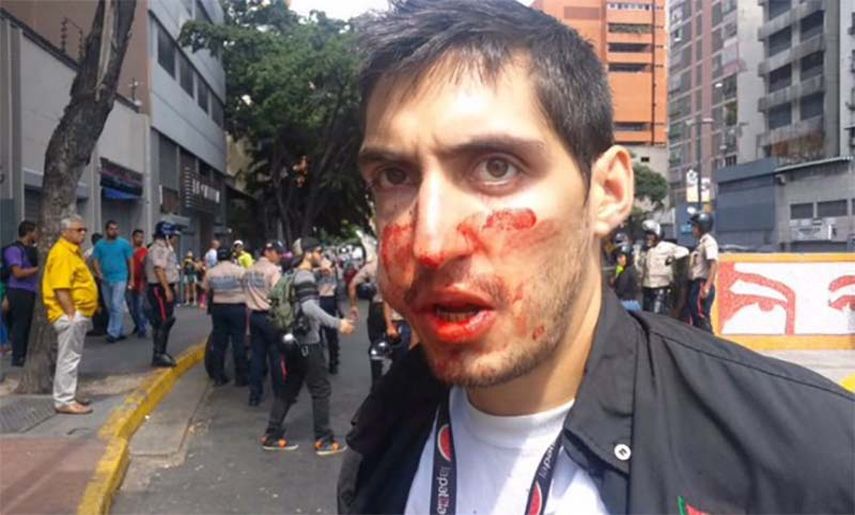E reportero gráfico Antonio Posteraro, recibió un fuerte golpe en la cara por lo que tuvo que ser atendido por los paramédicos (FOTO: caraotadigital.com)