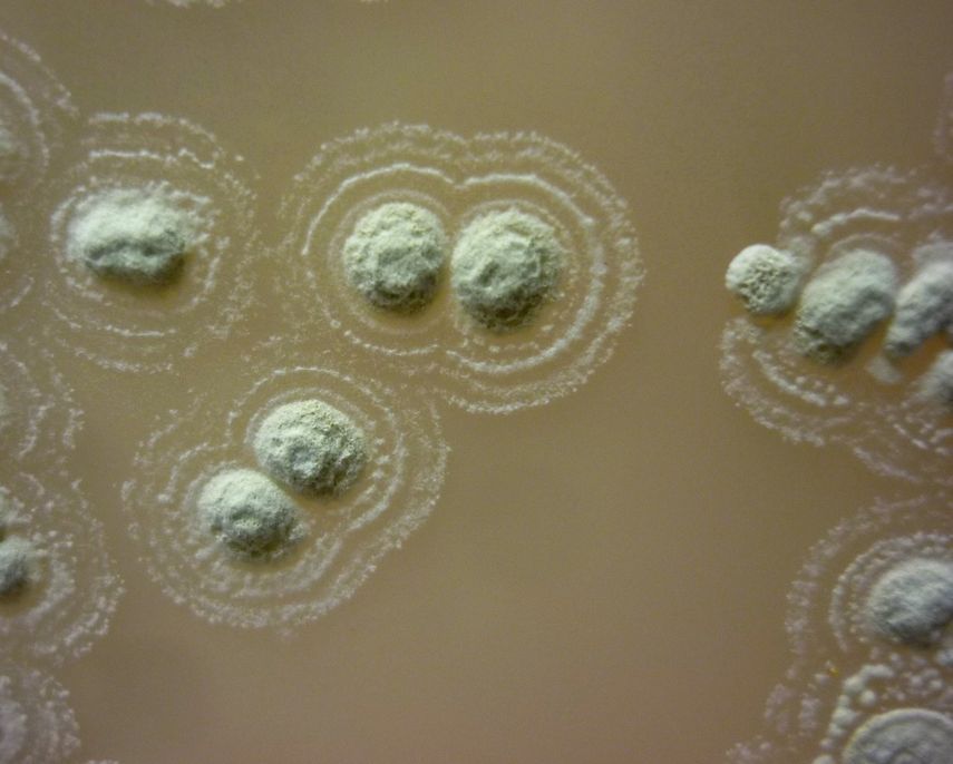 Una desconocida cepa de bacteria encontrada en suelos de Irlanda ha demostrado ser efectiva contra cuatro de las seis principales superbacterias resistentes a los antibióticos.