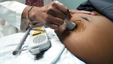 Una doctora realiza un ultrasonido a una embarazada para detectar el latido del feto, del 17 de diciembre de 2021, en Jackson, Mississippi.&nbsp;