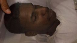 Cad&aacute;ver del joven Hansel Ernesto Hern&aacute;ndez Galiano, de Cuba.&nbsp;