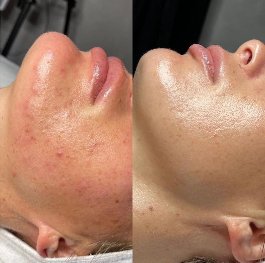 Antes y después del tratamiento.&nbsp;
