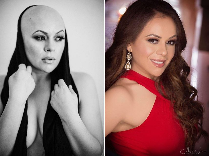 Priscilla Ferreyra dijo que la mejor manera de prevenir la mortalidad a causa del c&aacute;ncer de mama es la detecci&oacute;n temprana. &nbsp;