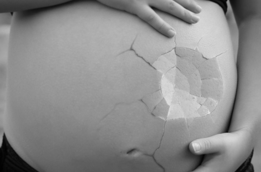 El Congreso de Honduras aprobó &nbsp;una reforma en la Constitución para endurecer la prohibición del aborto, vigente desde 1982