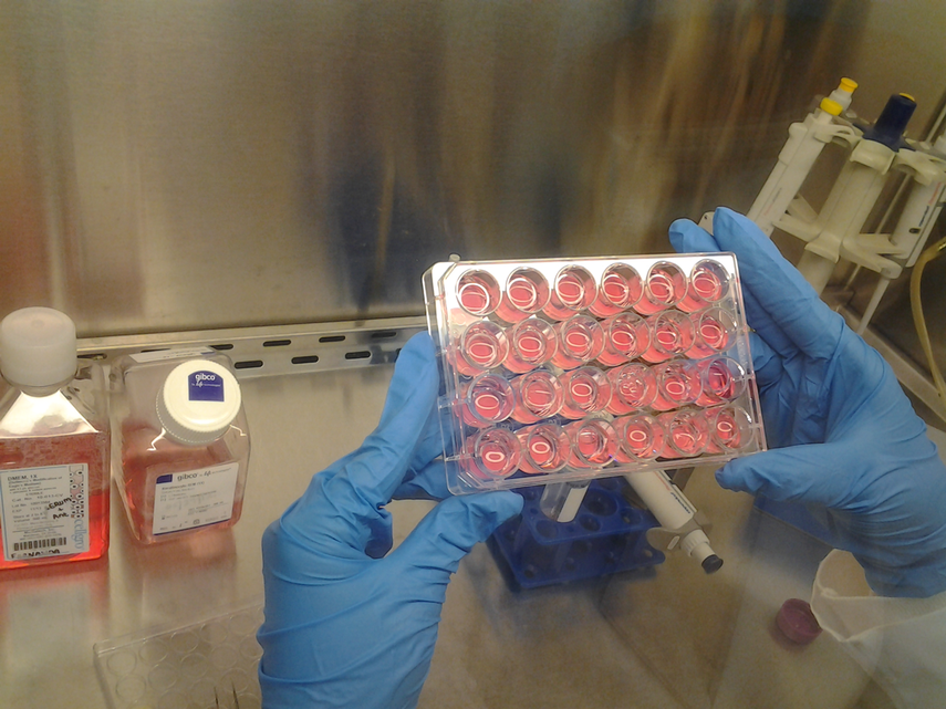 Ejemplo de un cultivo de piel e