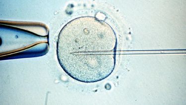 Desde hace unos años, en la Fecundación in Vitro se emplean de forma habitual las microinyecciones intracitoplasmáticas. (Archivo)