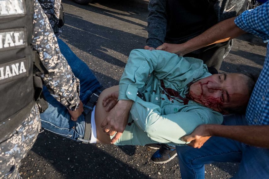 Falcón denunció el lunes el ataque del que fue objeto durante un acto en la zona de Catia, en el oeste de Caracas