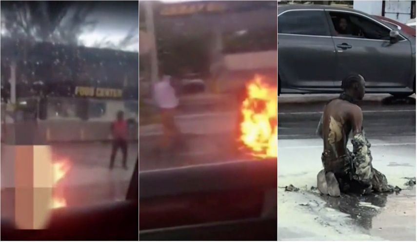 El hombre fue transportado al hospital Jackson Memorial para recibir atención por las quemaduras.&nbsp;