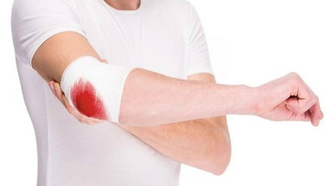 No hay reactivos en toda Venezuela y esto pone en riesgo a los pacientes que requieren transfusiones o atenciones especiales en caso de sufrir hemorragias o cualquier complicación de salud.