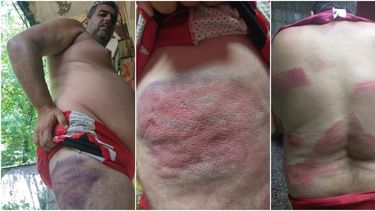 Agentes propinan brutal golpiza con bate a opositor cubano