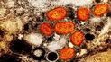 Esta imagen difundida por el Instituto Nacional de Alergias y Enfermedades Infecciosas de EEUU muestra una imagen a color captada con un microscopio electrónico de barrido en el que se ven partículas de viruela símica, en anaranjado, encontradas dentro de una célula infectada Esta imagen difundida por el Instituto Nacional de Alergias y Enfermedades Infecciosas de EEUU muestra una imagen a color captada con un microscopio electrónico de barrido en el que se ven partículas de viruela símica, en anaranjado, encontradas dentro de una célula infectada
