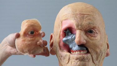 Una protesis a la medida puede cambiar la vida de quien la necesita. (Archivo)