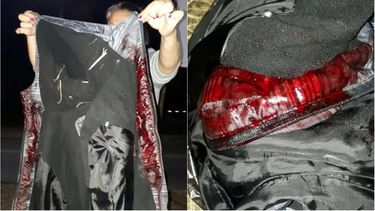 Una manifestante muestra una prenda de ropa manchada de sangre tras el ataque en el campamento de Curitiba.&nbsp;
