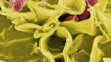 El brote, que inició entre el 16 de noviembre del 2017 y el 14 de abril del 2018, ha provocado el retiro de más de 200 millones de huevos del mercado en todo Estados Unidos.