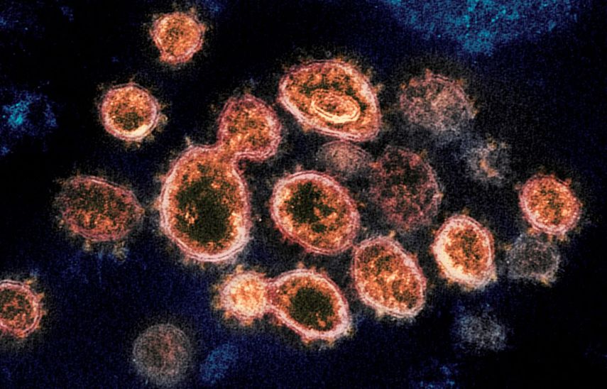 En esta imagen tomada con un microscopio electrónico en 2020, cortesía de los Laboratorios de las Montañas Rocosas de los Institutos Nacionales de la Salud, se ven partículas del virus SARS-CoV-2, causantes del COVID-19, aisladas de un paciente en Estados Unidos. 
