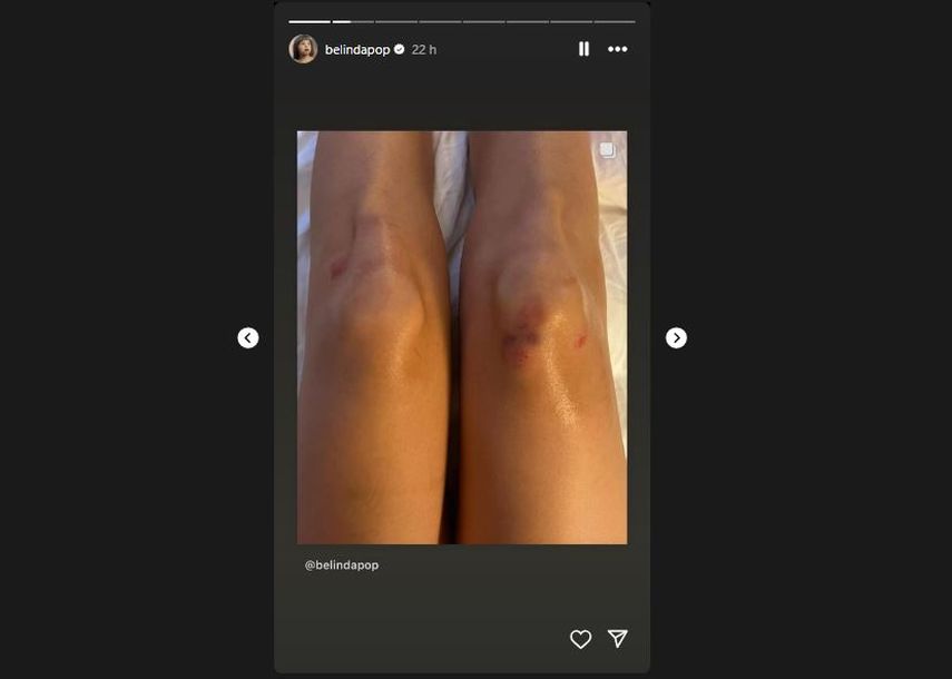 Belinda muestra sus rodillas tras caída en pasarela de L'Oreal. 